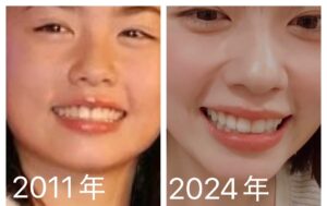 小芝風花さんの画像