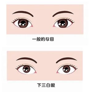 三白眼の画像